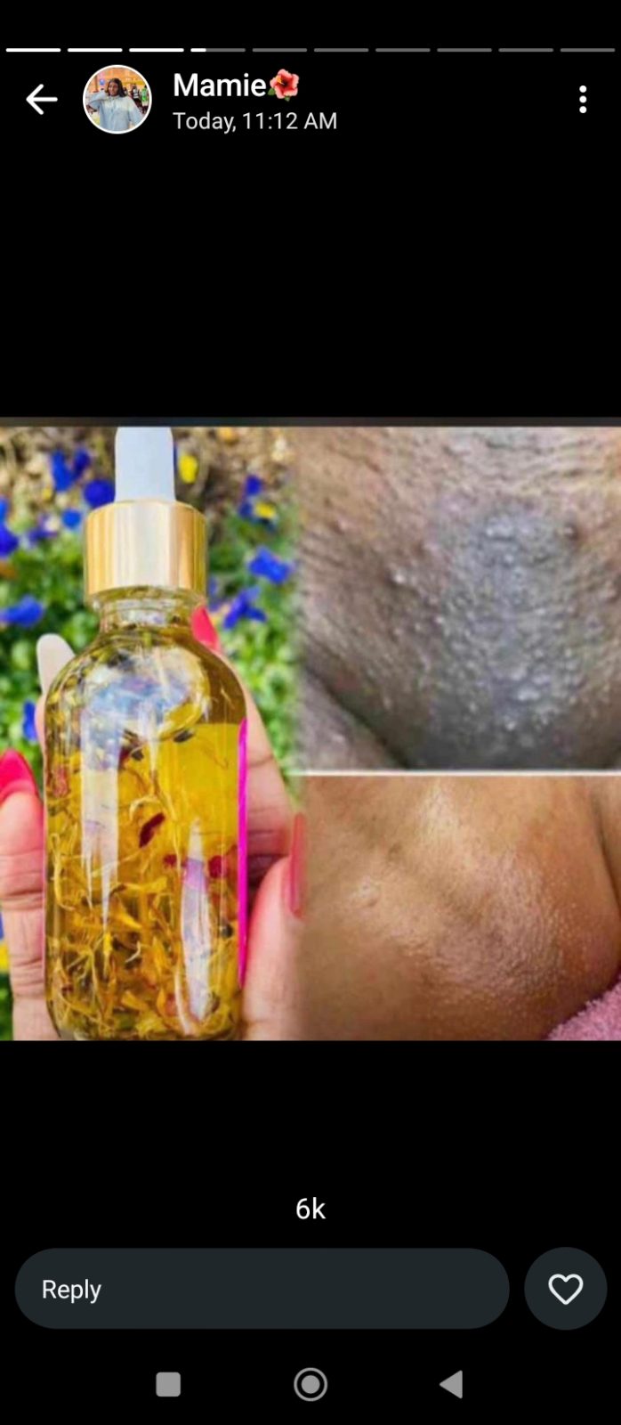 Yoni oil